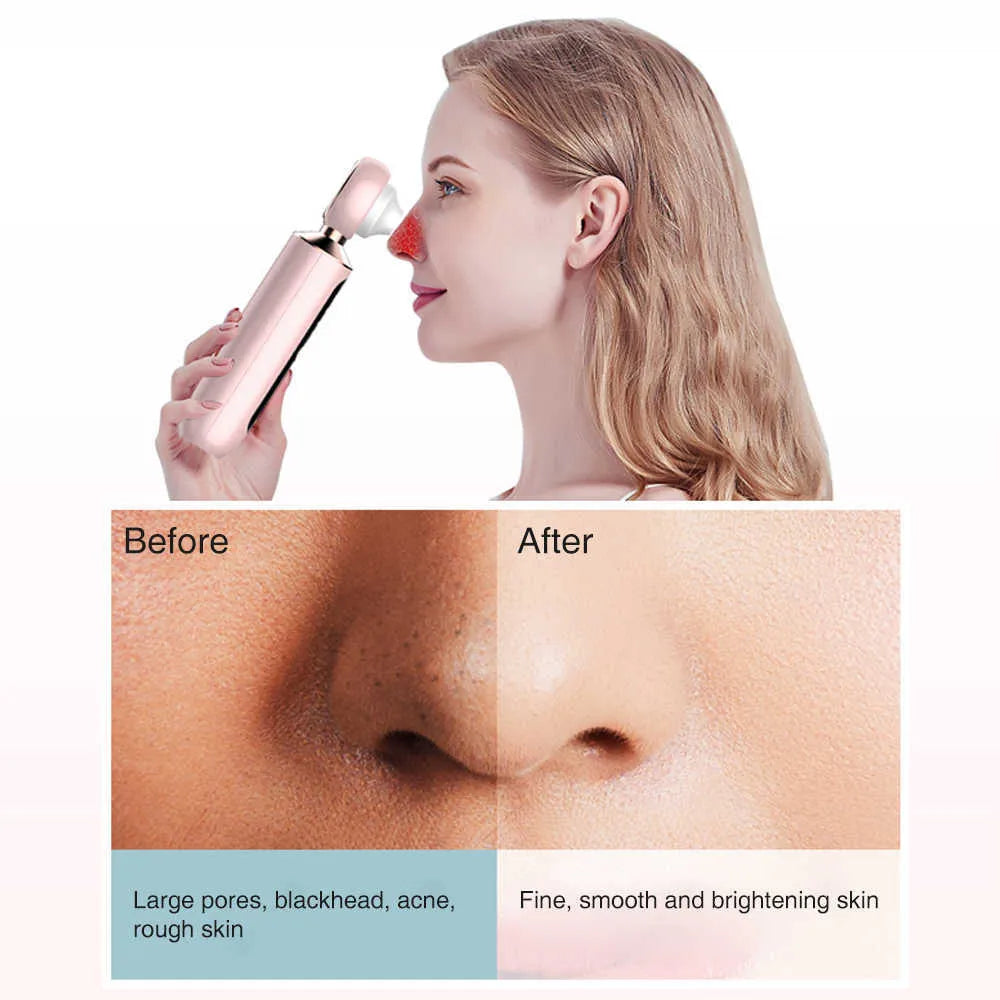 Beauty'N Drops™ Blackhead Suction Machine