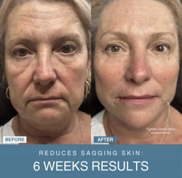Beauty'N Drops™ 7-in-1 LED Anti-Aging/Wrinkle Apparatus