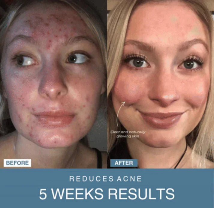 Beauty'N Drops™ 7-in-1 LED Anti-Aging/Wrinkle Apparatus